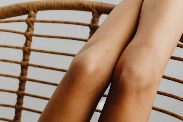 Улучшение тонуса кожи на коленях с помощью SMAS Лифтинга Ultraformer
